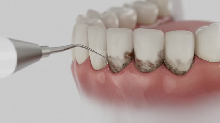 Trusted Wisdom Tooth Removal service in Lake Camelot, WI - Dentist Open Now